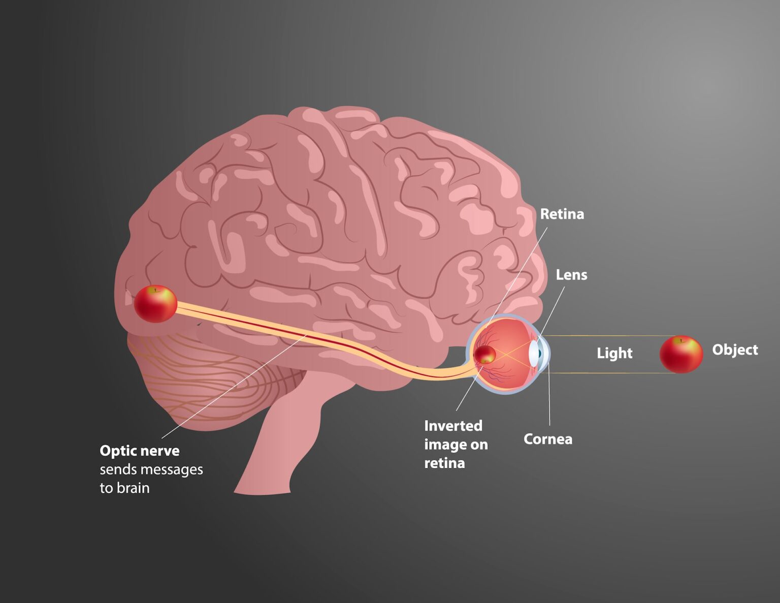 How do Neurological Disorders Affect Your Eyes?