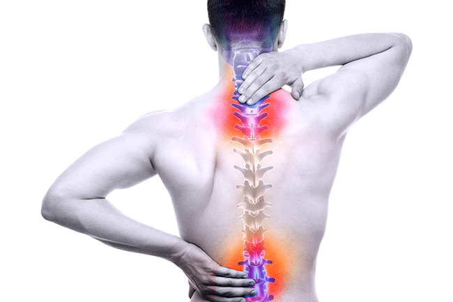 Degenerative disc disease icon